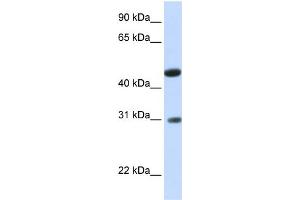 WB Suggested Anti-LOC388323 Antibody Titration:  0. (GLTPD2 抗体  (N-Term))