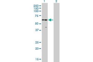 Western Blot analysis of PKNOX2 expression in transfected 293T cell line by PKNOX2 MaxPab polyclonal antibody. (PKNOX2 抗体  (AA 1-471))