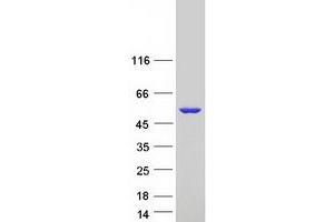 Western Blotting (WB) image for Epoxide Hydrolase 1, Microsomal (Xenobiotic) (EPHX1) (Transcript Variant 2) protein (Myc-DYKDDDDK Tag) (ABIN2720324)