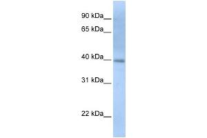 WB Suggested Anti-ITPK1 Antibody Titration: 0. (ITPK1 抗体  (N-Term))