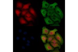 ABIN6254880 and ABIN6268792 staining Hela cells by IF/ICC. (Caspase 9 抗体  (Cleaved-Asp330))