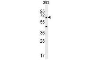 ANKRD34B Antibody (C-term) western blot analysis in 293 cell line lysates (35µg/lane). (ANKRD34B 抗体  (C-Term))