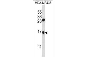 GNLY Antibody (N-term) (ABIN656999 and ABIN2846178) western blot analysis in MDA-M cell line lysates (35 μg/lane). (GNLY 抗体  (N-Term))
