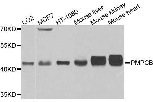 Western blot analysis of extracts of various cell lines, using PMPCB antibody (ABIN5972414) at 1/1000 dilution. (PMPCB 抗体)