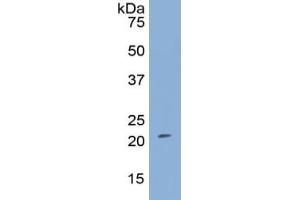 WB of Protein Standard: different control antibodies against Highly purified E.