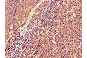 Immunohistochemistry of paraffin-embedded human lymph node tissue using ABIN7157511 at dilution of 1:100