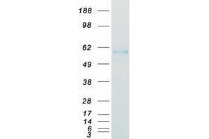 Western Blotting (WB) image for Cathepsin A (CTSA) (Transcript Variant 1) protein (Myc-DYKDDDDK Tag) (ABIN2713225)