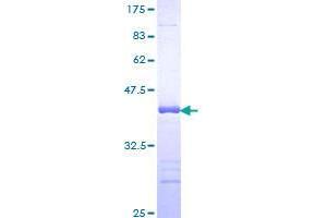 FAF1 Protein (AA 551-650) (GST tag)