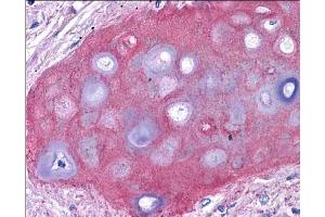 Immunohistochemistry of Rabbit Anti-Collagen II Biotin Conjugated Antibody.