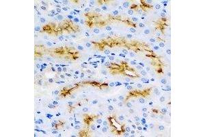 Immunohistochemical analysis of BMP15 staining in rat kidney formalin fixed paraffin embedded tissue section. (BMP15 抗体)