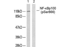 Western blot analysis of extracts from ovary cancer cells using NF-κ,B p100 (phospho-Ser866) antibody. (NFKB2 抗体  (pSer866))