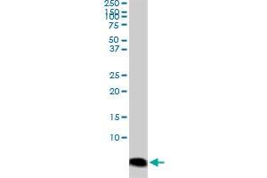 ATOX1 monoclonal antibody (M04), clone 3G11. (ATOX1 抗体  (AA 1-68))
