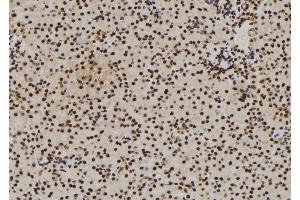 ABIN6272913 at 1/100 staining Mouse kidney tissue by IHC-P. (DDX21 抗体  (Internal Region))
