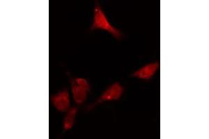 ABIN6274116 staining HeLa cells by IF/ICC. (DKC1 抗体  (Internal Region))