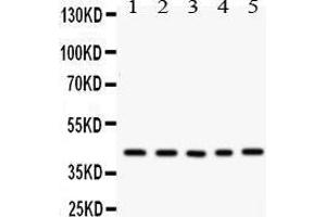 Western Blotting (WB) image for anti-Cysteine-Rich, Angiogenic Inducer, 61 (CYR61) (AA 54-381) antibody (ABIN3042351) (CYR61 抗体  (AA 54-381))