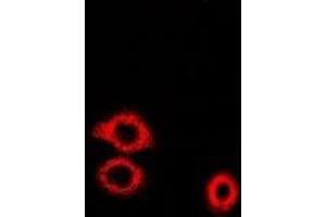 Immunofluorescent analysis of ADE2 staining in U2OS cells. (PAICS 抗体)
