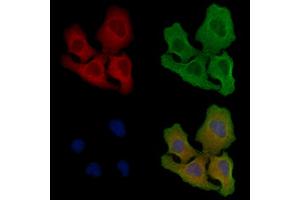 ABIN6258909 and ABIN6275877 staining Hela cells by IF/ICC. (IREM1 抗体  (Internal Region))