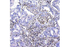Immunohistochemistry (IHC) image for anti-CD44 (CD44) (AA 21-259) antibody (ABIN5692819)