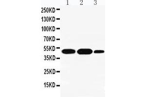 Anti-INDOL1 antibody, Western blotting Lane 1: A549 Cell Lysate Lane 2: Human Placenta Tissue Lysate Lane 3: A431 Cell Lysate (IDO2 抗体  (N-Term))