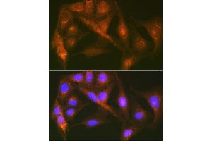 Immunofluorescence analysis of U-2 OS cells using Cortactin Rabbit mAb (ABIN7266511) at dilution of 1:100 (40x lens). (Cortactin 抗体)