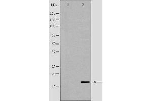 Western blot analysis of human testis lysate using LYZL6 antibody. (LYZL6 抗体  (Internal Region))