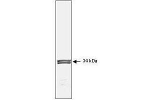 Western Blotting (WB) image for anti-Cyclin-Dependent Kinase 1 (CDK1) antibody (ABIN129504)