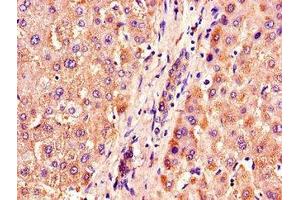 Immunohistochemistry of paraffin-embedded human liver tissue using ABIN7162949 at dilution of 1:100 (ACOX1 抗体  (AA 113-273))