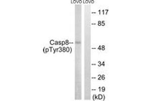 Western blot analysis of extracts from LOVO cells treated with UV 15', using Caspase 8 (Phospho-Tyr380) Antibody. (Caspase 8 抗体  (pTyr380))