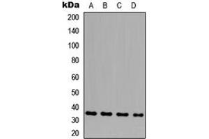 Western blot analysis of GLB1L3 expression in HeLa (A), THP1 (B), NS-1 (C), H9C2 (D) whole cell lysates. (GLB1L3 抗体  (Center))