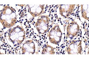 Detection of CASP10 in Human Colon Tissue using Polyclonal Antibody to Caspase 10 (CASP10) (Caspase 10 抗体  (AA 223-459))