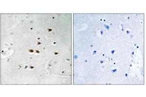 Immunohistochemistry analysis of paraffin-embedded human brain tissue using ITCH (Phospho-Tyr420) antibody.