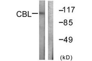 Western blot analysis of extracts from HeLa cells, treated with EGF 200ng/ml 30', using CBL (Ab-774) Antibody. (CBL 抗体  (AA 740-789))