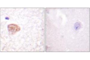 Immunohistochemistry analysis of paraffin-embedded human brain tissue, using DDX3/DEAD-box Protein 3 (Ab-322) Antibody.