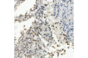 IHC analysis of FOXF1 using anti-FOXF1 antibody (ABIN7601744). (FOXF1 抗体  (AA 44-379))