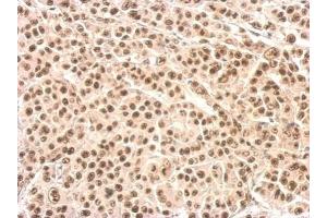 Immunohistochemistry (IHC) image for anti-X-Ray Repair Complementing Defective Repair in Chinese Hamster Cells 4 (XRCC4) (C-Term) antibody (ABIN2856695)
