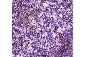 Immunohistochemistry (IHC) image for anti-Annexin A6 (ANXA6) (AA 395-665) antibody (ABIN5692982)