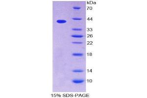 SDS-PAGE (SDS) image for Chemokine (C-C Motif) Ligand 4-Like 1 (CCL4L1) (AA 24-92) protein (His tag,GST tag) (ABIN2122612)