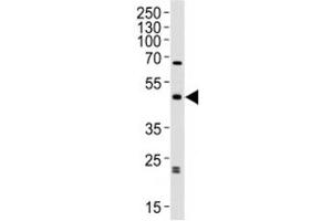 Western blot analysis of lysate from human brain tissue lysate using ABHD12 antibody diluted at 1:1000.