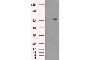 HEK293T cells were transfected with the pCMV6-ENTRY control (Left lane) or pCMV6-ENTRY HDAC10 (Right lane) cDNA for 48 hrs and lysed. (HDAC10 抗体)