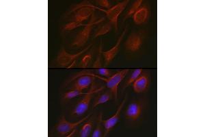 Immunofluorescence analysis of U2OS cells using TR antibody (ABIN3023477, ABIN3023478, ABIN3023479 and ABIN6220053) at dilution of 1:50. (TRAF7 抗体)