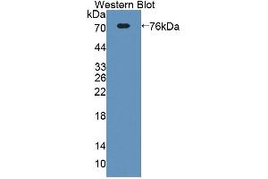 Western blot analysis of the recombinant protein. (ECM1 抗体  (AA 20-434))