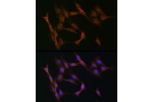 Immunofluorescence analysis of C6 cells using TGF beta Receptor II (TGF beta Receptor II (TGFBR2)) Rabbit pAb (ABIN6130734, ABIN6149084, ABIN6149087 and ABIN6215460) at dilution of 1:50 (40x lens). (TGFBR2 抗体  (AA 23-280))