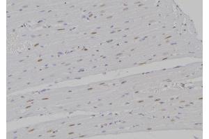 ABIN6277199 at 1/100 staining Rat heart tissue by IHC-P.
