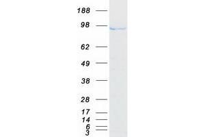 Western Blotting (WB) image for Anaphase Promoting Complex Subunit 2 (ANAPC2) protein (Myc-DYKDDDDK Tag) (ABIN2714781)