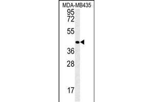 Western blot analysis in MDA-MB435 cell line lysates (35ug/lane). (Vasohibin 2 抗体  (C-Term))