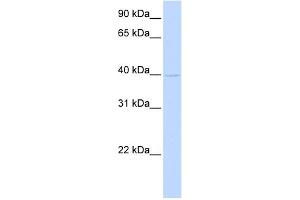 WB Suggested Anti-TMOD2 Antibody Titration: 0. (TMOD2 抗体  (N-Term))