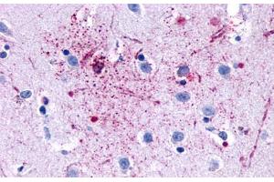 Anti-GPR139 antibody  ABIN1048723 IHC staining of human brain, neurons and glia. (GPR139 抗体  (Transmembrane Domain))