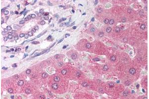 Human Liver (formalin-fixed, paraffin-embedded) stained with PARP2 antibody ABIN214132 at 5 ug/ml followed by biotinylated goat anti-rabbit IgG secondary antibody ABIN481713, alkaline phosphatase-streptavidin and chromogen. (PARP2 抗体  (AA 401-450))