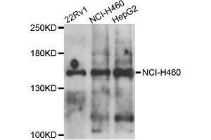 Western blot analysis of extracts of various cells, using COL4A5 antibody. (COL4a5 抗体)