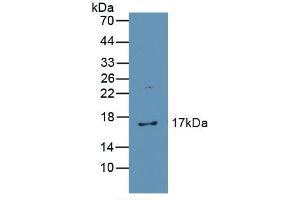 Western blot analysis of recombinant Human CAT. (Catalase 抗体  (AA 32-167))